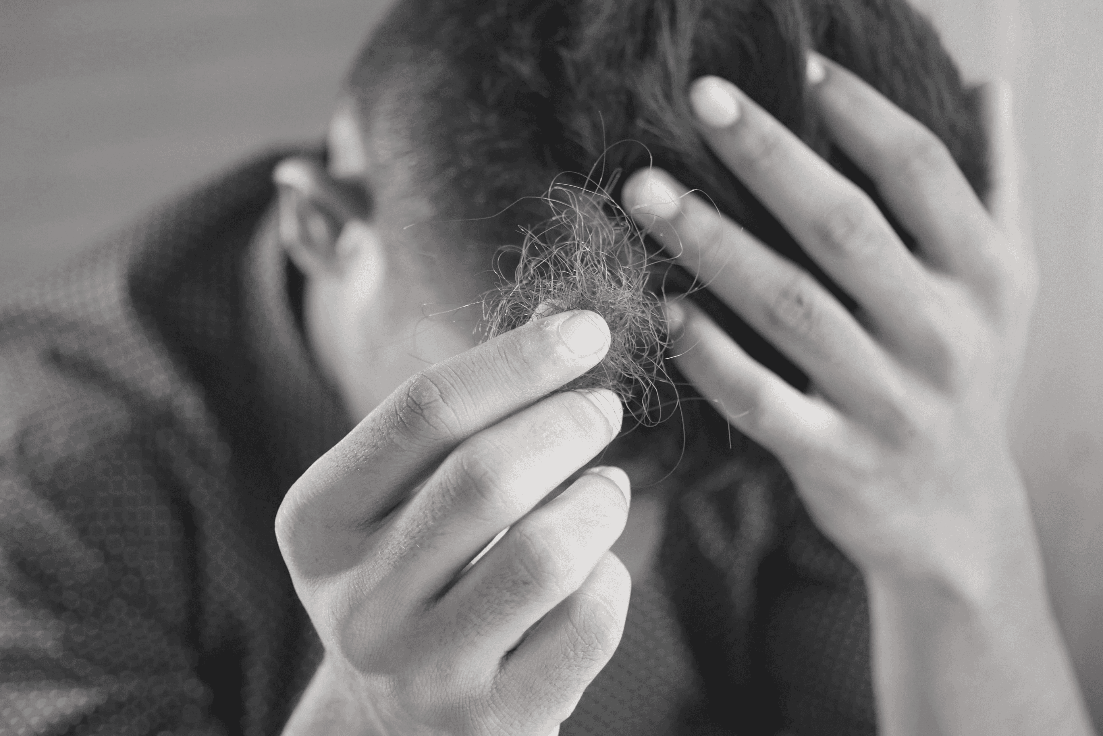 Woman experiencing hair loss frustration