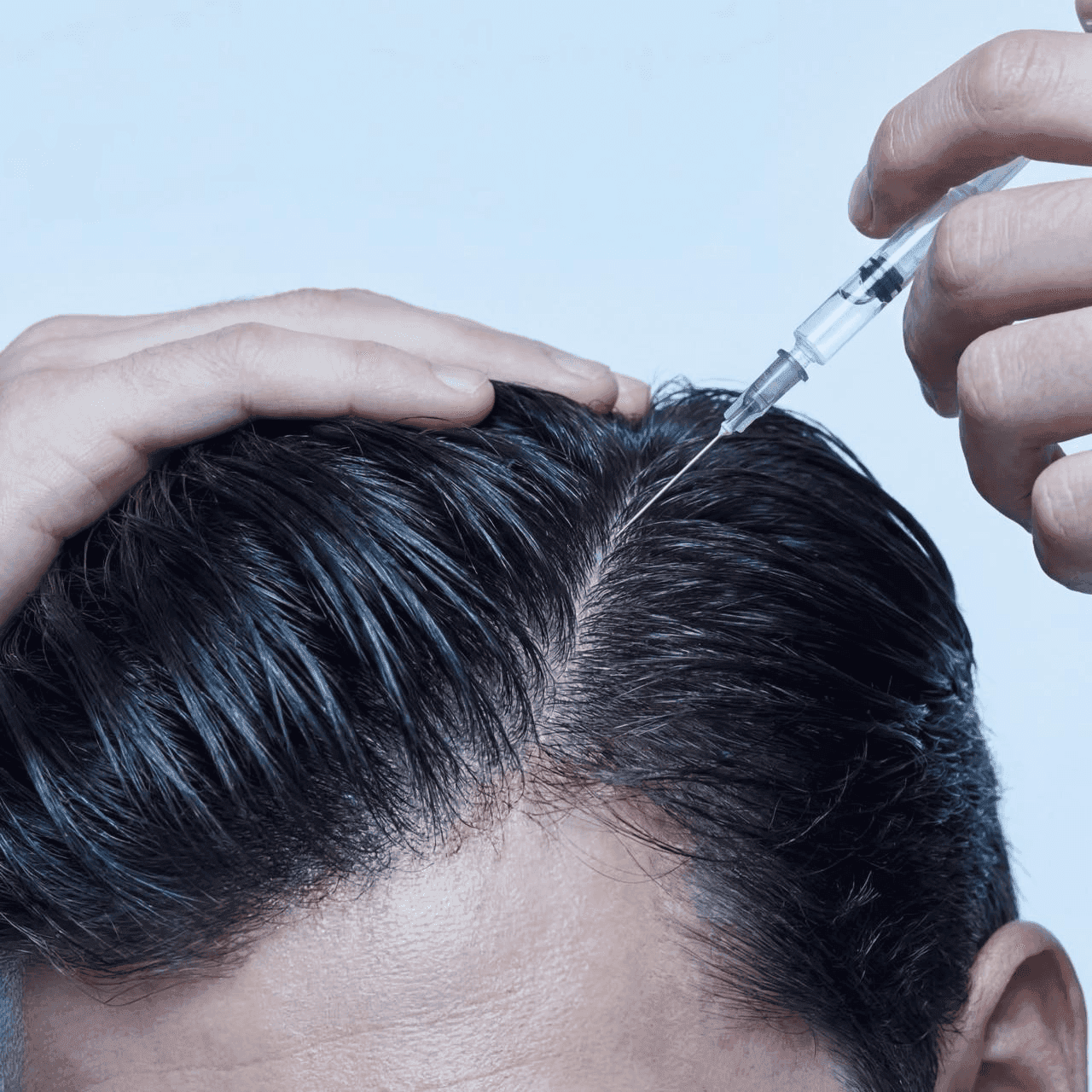 Precision scalp injection treatment